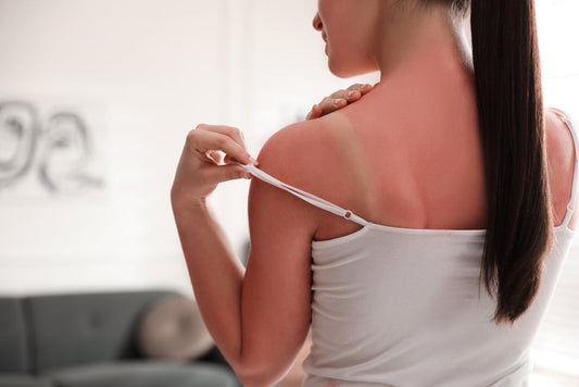 The Impact of Sun Exposure on Skin Health
